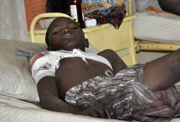 ילד ניגרי שנפצע בהתקפה על מסגד שביצע ארגון הבוקו חראם (צילום:  רויטרס)
