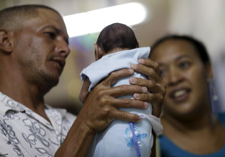 תינוקת הסובלת ממיקרוצפליה, כתוצאה מנגיף הזיקה בברזיל. צילום: רויטרס