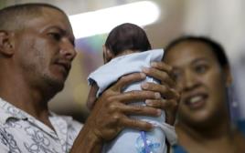 תינוקת הסובלת ממיקרוצפליה, כתוצאה מנגיף הזיקה בברזיל (צילום: רויטרס)