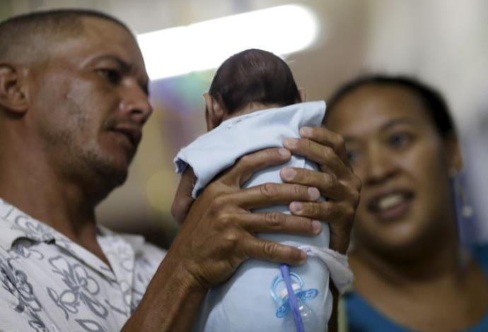 תינוקת הסובלת ממיקרוצפליה, כתוצאה מנגיף הזיקה בברזיל (צילום:  רויטרס)