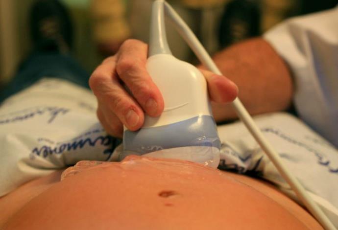 אישה בהריון בבדיקה אצל גניקולוג, ארכיון (צילום:  חן לאופולד, פלאש 90)