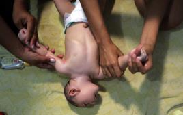 ילד הסובל מתסמיני זיקה, ברזיל (צילום: רויטרס)