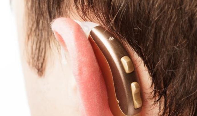 Artificial intelligence-based application: Tuned – fitting tests for a hearing aid