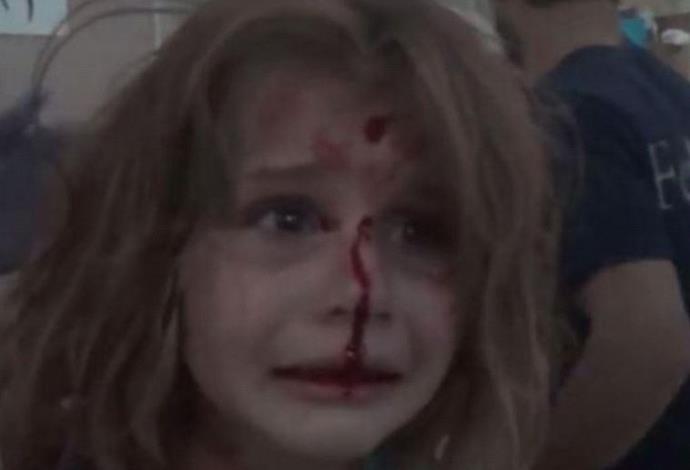 ילדה פצועה בחומס, סוריה (צילום:  צילום מסך)
