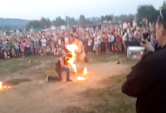 אופס. בולע אש הצית את פניו בטעות במהלך מופע (צילום:  צילום מסך)